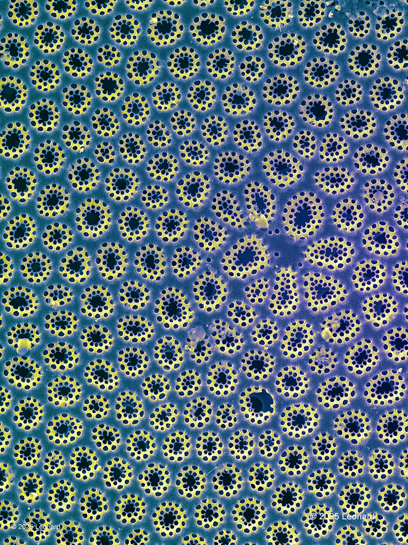 Electron micrograph of pattern on diatom.