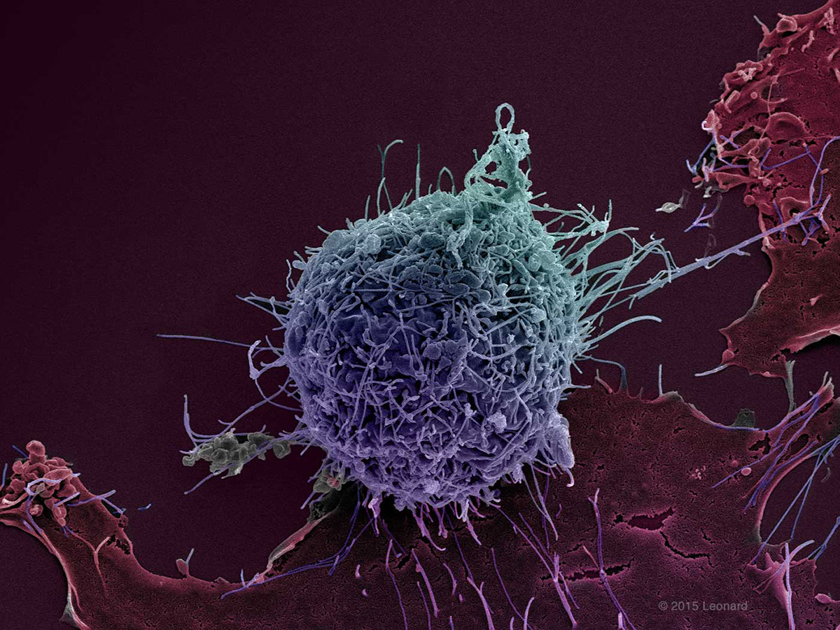 Breast Cancer Cells (BT549 Triple Negative)