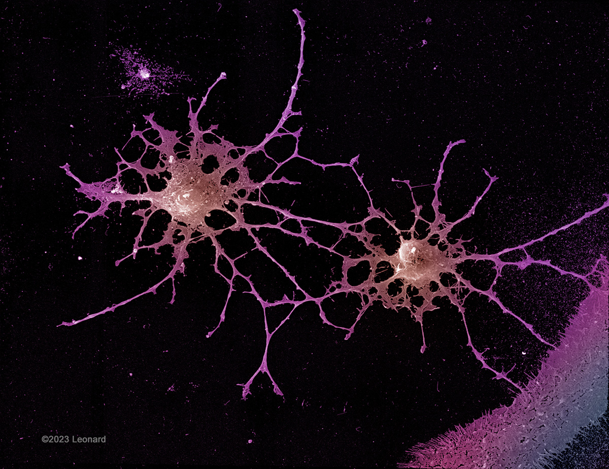 Two Neurons