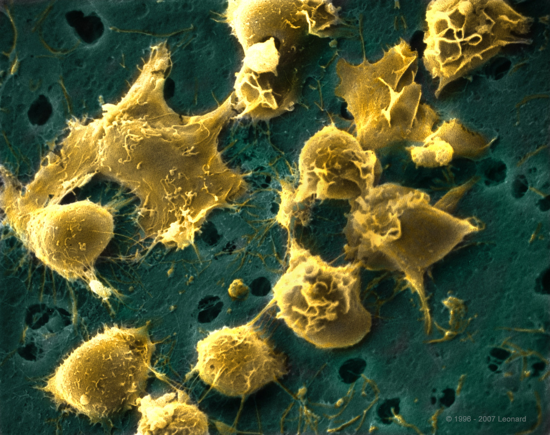 Hematopoietic-derived