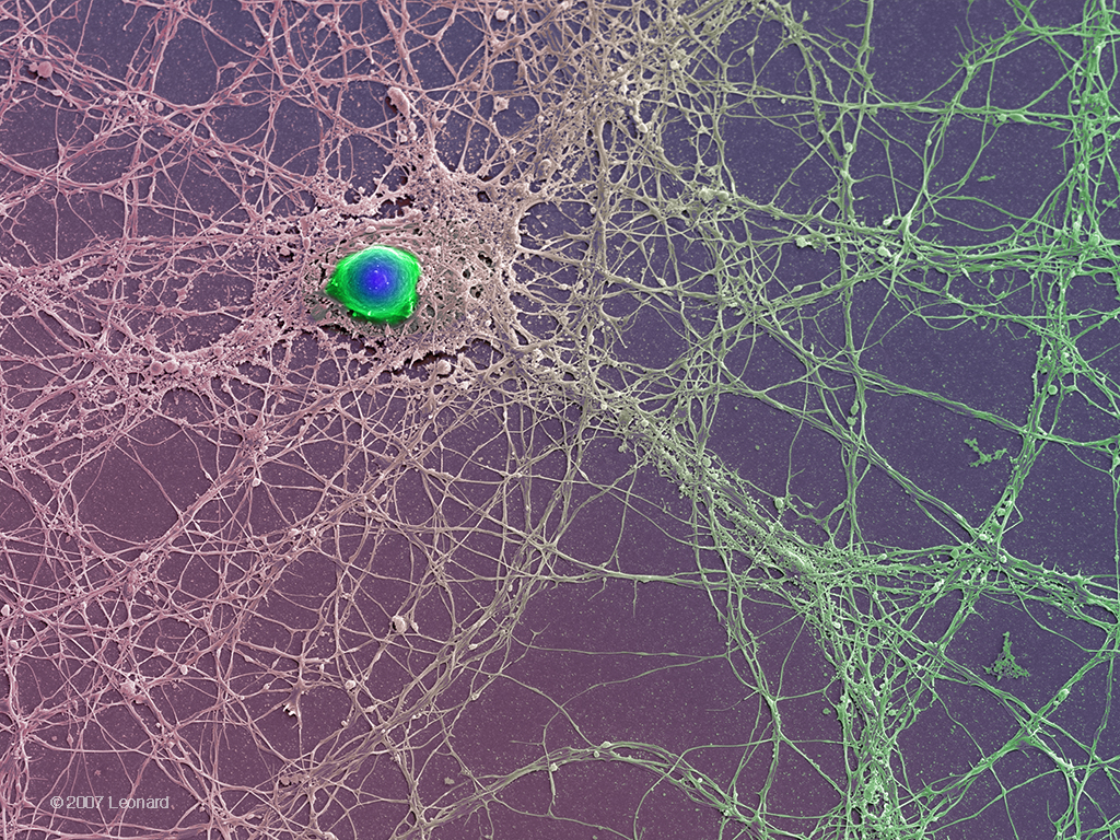 Neuron with Complex Neural Network of Dentrites