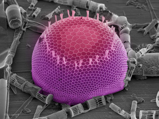 Hudson River Diatoms