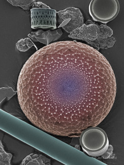 Myriad of Hudson River Diatoms