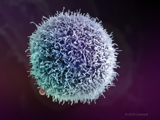 Breast Cancer Cell