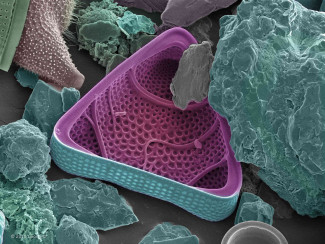 Hudson River Diatoms