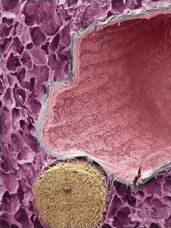 Lung tissue showing airsacks (alveoli) brachial and blood vessel