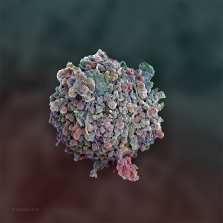 Monocyte derived dendritic cell