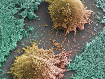 Embryonic Stem Cells Pair