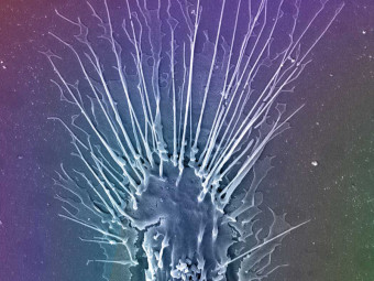 Monocyte-Derived Dendritic Cell Interacting with Talc