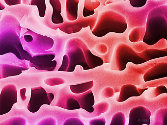 Follicle Stimulating Hormone Product: A  lyophilized injectable drug to enable fertility.