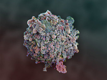 Monocyte derived dendritic cell