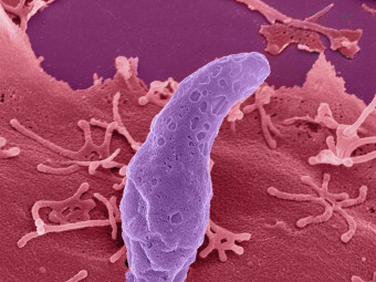 Toxoplasma gondii parasite