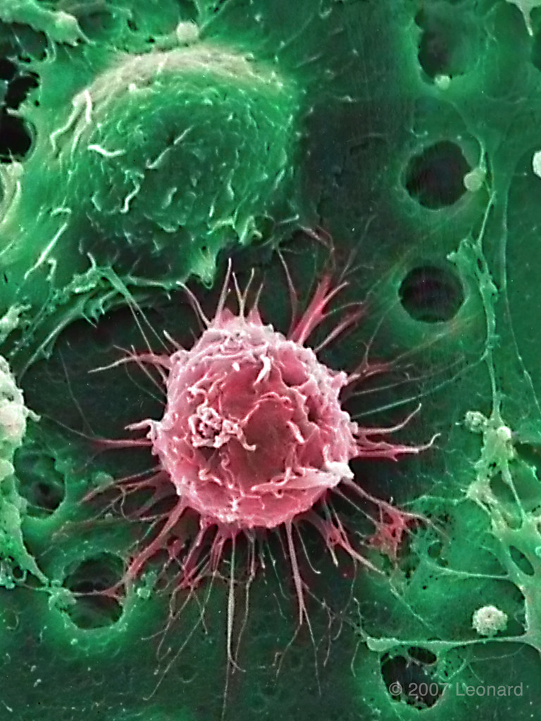 Hematopoietic Bone Marrow Stem Cell